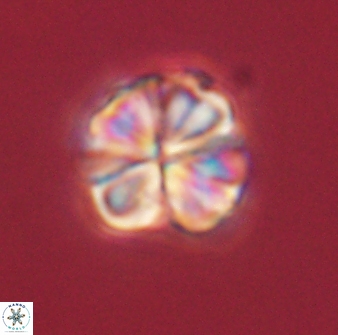 Sphenolithus bouketo 60452