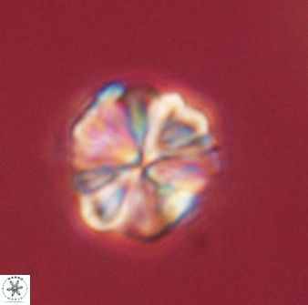 Sphenolithus bouketo 60453
