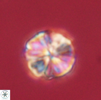 Sphenolithus bouketo 60434