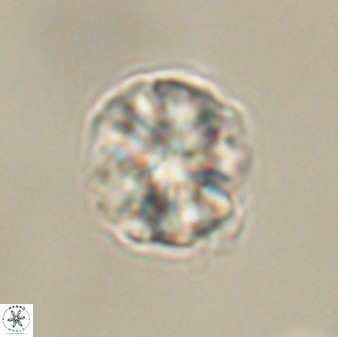 Sphenolithus bouketo 60439