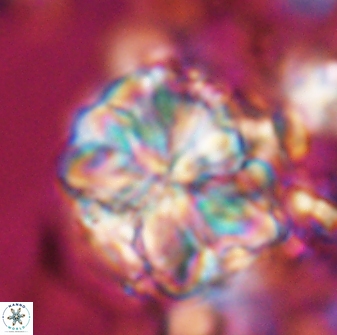 Sphenolithus bouketo 25931