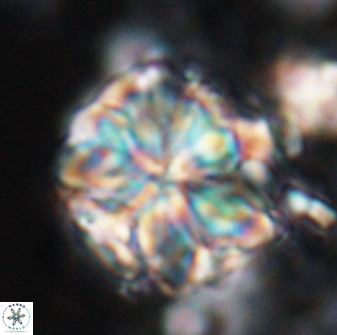 Sphenolithus bouketo 25932