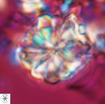 Sphenolithus bouketo 25936
