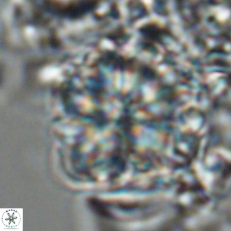 Sphenolithus bouketo 25937