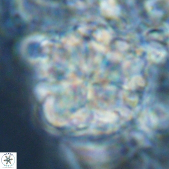 Sphenolithus bouketo 25938