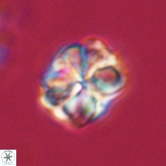 Sphenolithus bouketo 28696