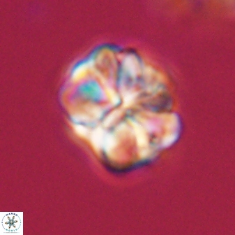 Sphenolithus bouketo 28699