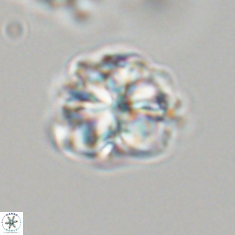 Sphenolithus bouketo 28700