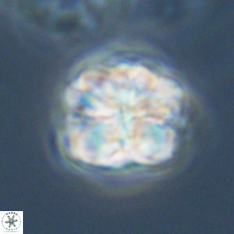 Sphenolithus bouketo 28702