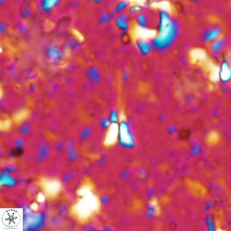 Sphenolithus belemnos 14288