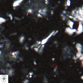 Sphenolithus belemnos 14289