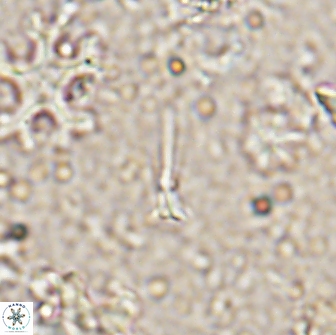 Sphenolithus belemnos 14291