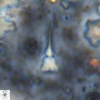 Sphenolithus belemnos 14294