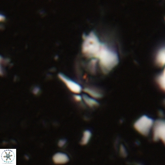 Sphenolithus belemnos 247