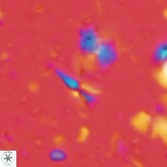 Sphenolithus belemnos 248