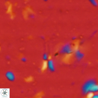 Sphenolithus belemnos 249
