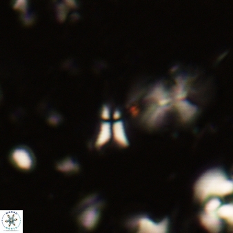 Sphenolithus belemnos 250