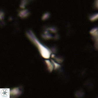 Sphenolithus belemnos 251