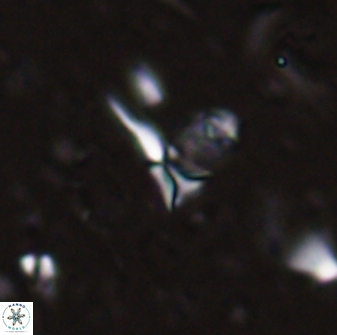 Sphenolithus belemnos 28128