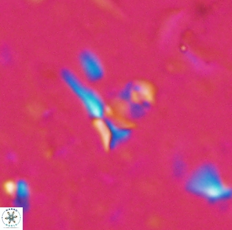 Sphenolithus belemnos 28129