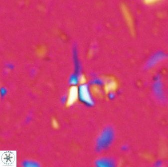 Sphenolithus belemnos 28130