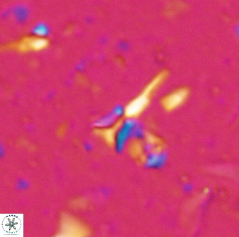 Sphenolithus belemnos 28133