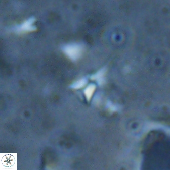Sphenolithus belemnos 28134