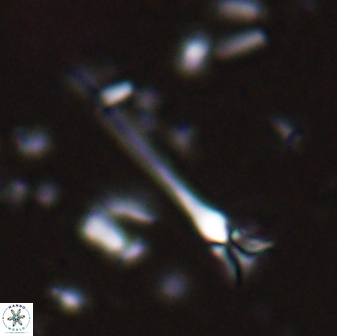 Sphenolithus belemnos 28156