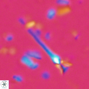 Sphenolithus belemnos 28157