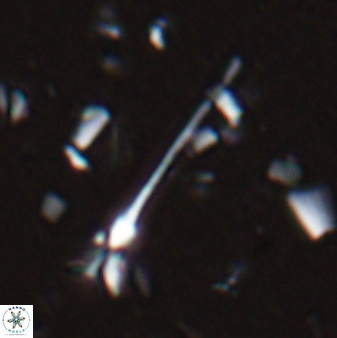 Sphenolithus belemnos 28160