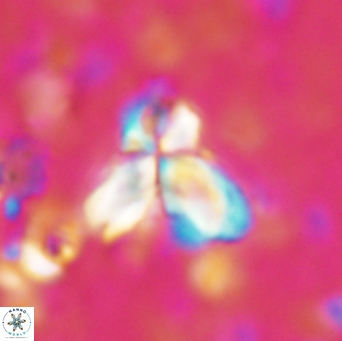 Sphenolithus bipedis 1954