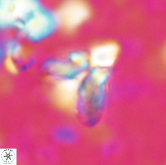 Sphenolithus bipedis 1955