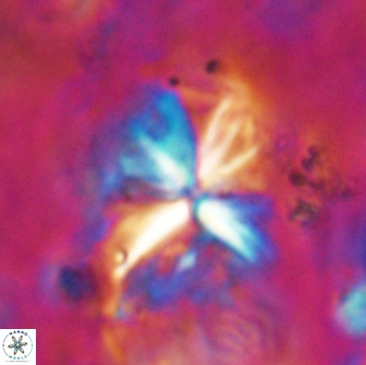 Sphenolithus grandis 19548