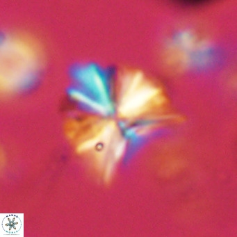 Sphenolithus grandis VR 10579