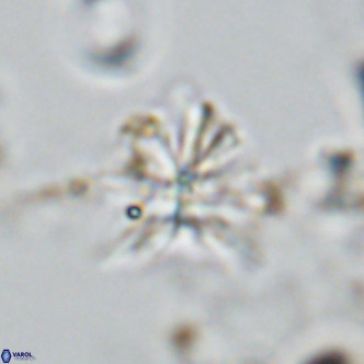 Sphenolithus grandis VR 10582