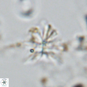 Sphenolithus grandis VR 10582