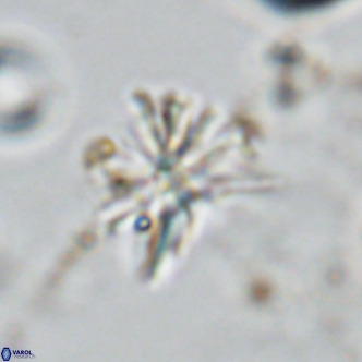 Sphenolithus grandis VR 10583