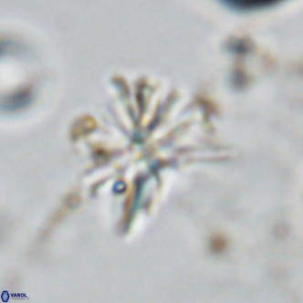 Sphenolithus grandis VR 10583