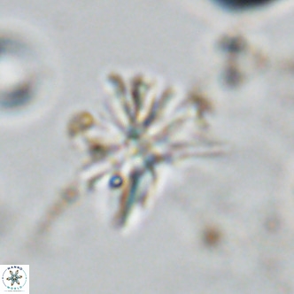 Sphenolithus grandis VR 10583