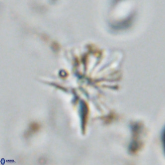 Sphenolithus grandis VR 10584