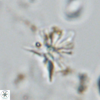 Sphenolithus grandis VR 10584