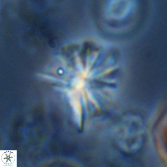 Sphenolithus grandis VR 10587