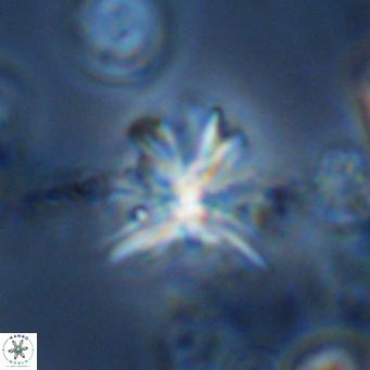 Sphenolithus grandis VR 10589