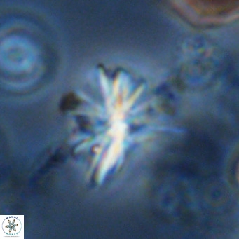 Sphenolithus grandis VR 10590