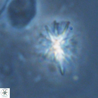 Sphenolithus grandis VR 16742