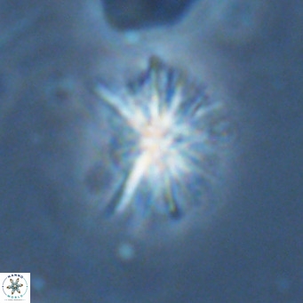 Sphenolithus grandis VR 16744