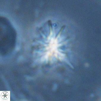 Sphenolithus grandis VR 16745