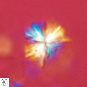 Sphenolithus grandis VR 16727