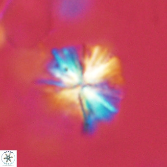 Sphenolithus grandis VR 16730