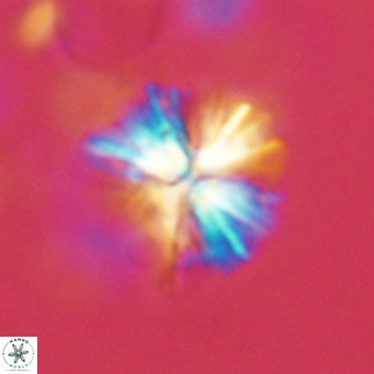 Sphenolithus grandis VR 16734